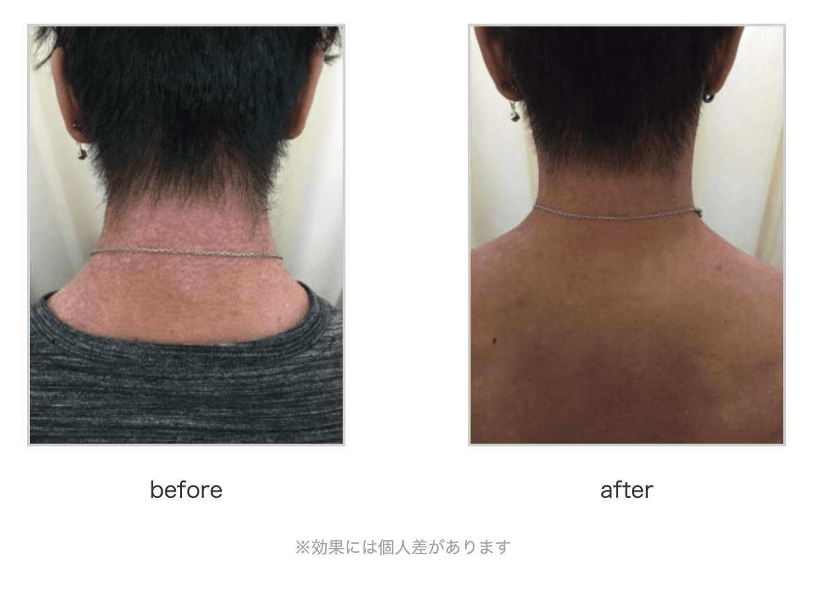 スクリーンショット 2025-10-23 23.07.26.png